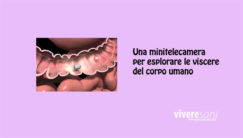 Capsula Endoscopica: importante strumento diagnostico Capsula Endoscopica: importante strumento diagnostico